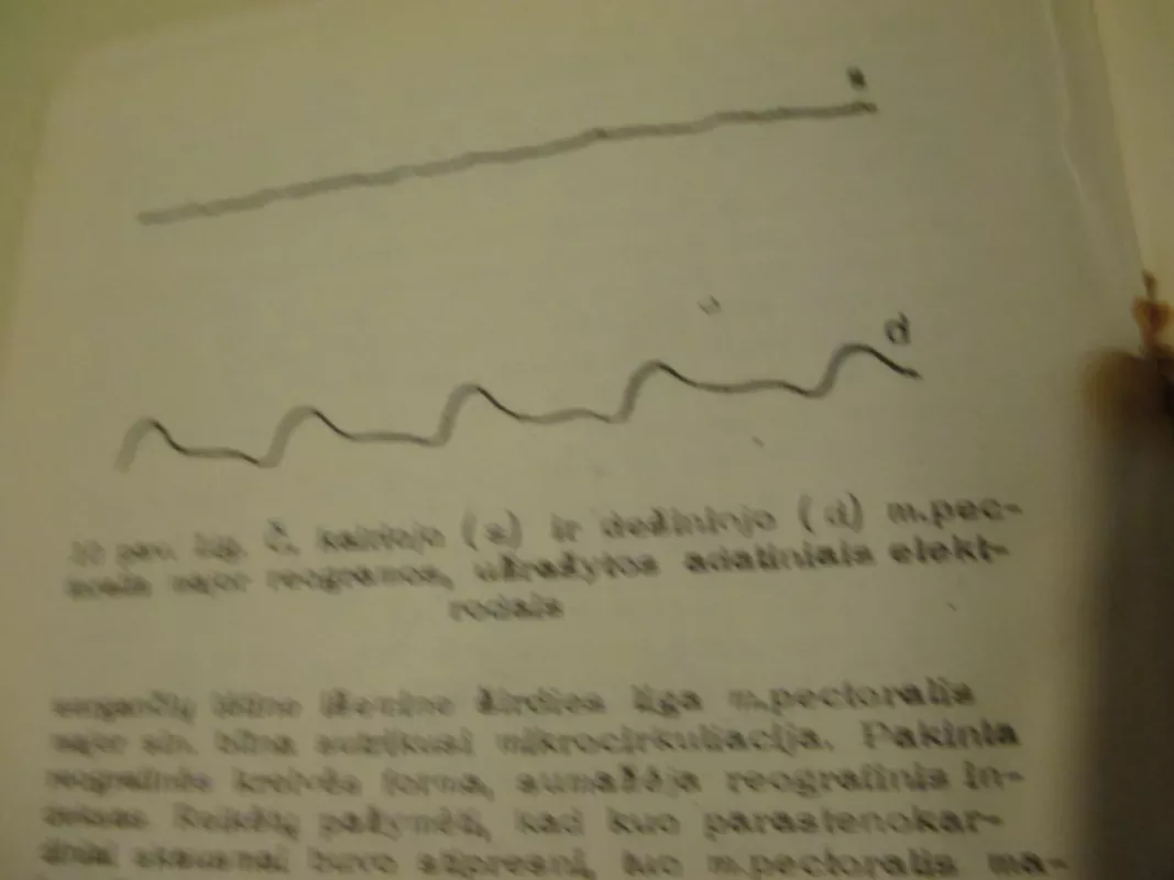 Parastenokardiniai skausmai - Danutė Kaunaitė, knyga 6