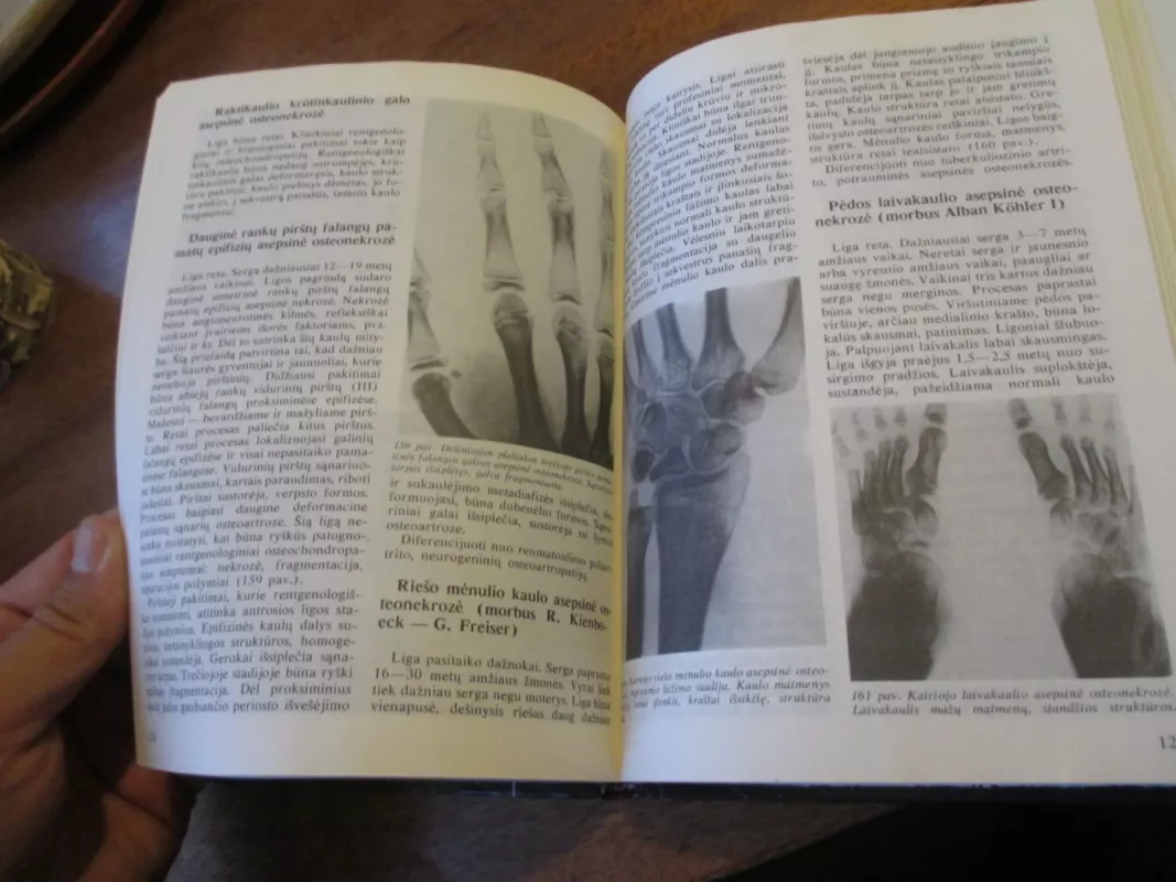 Atramos judamojo aparato ligų rentgenodiagnostika - Kazys Ambrozaitis, knyga 6