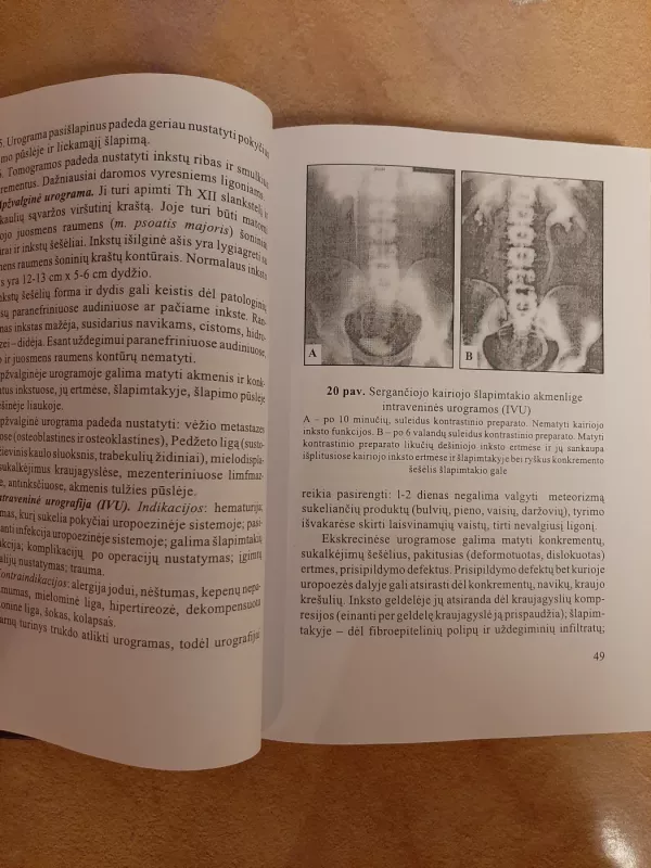 Urologijos Pradmenys - A. Radavičius, knyga 6