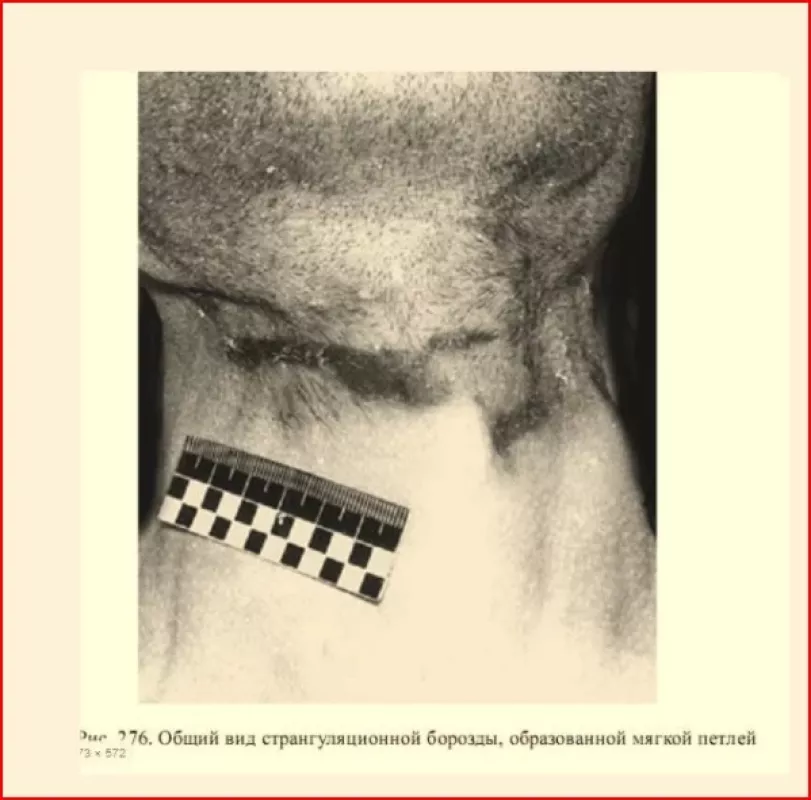 Lavono apžiūra įvykio vietoi - Aleksandras Matyševas, knyga 5