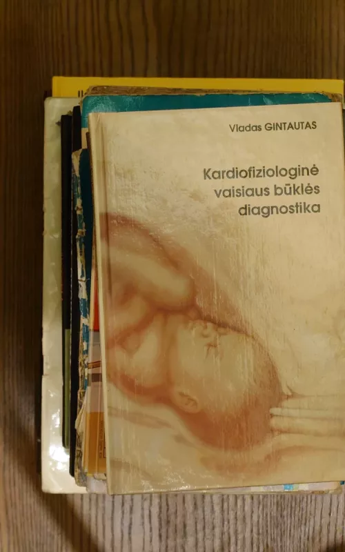 Kardiofiziologinė vaisiaus būklės diagnostika - Vladas Gintautas, knyga