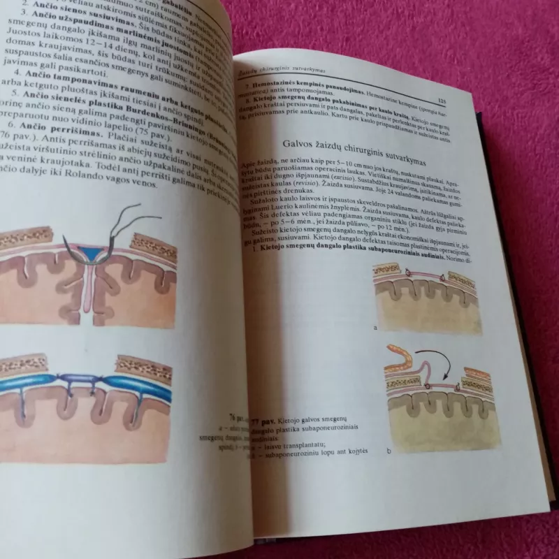 Topografinė anatomija ir operacinė chirurgija - Jurgis Brėdikis, knyga 5