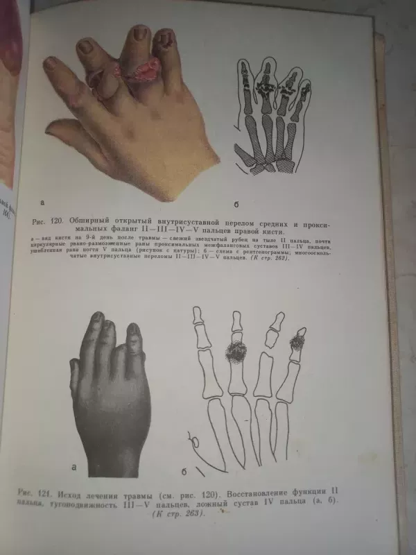 Hirurgija zabolevanij i povreždenij kisti - Usolceva  Maškara, knyga 6