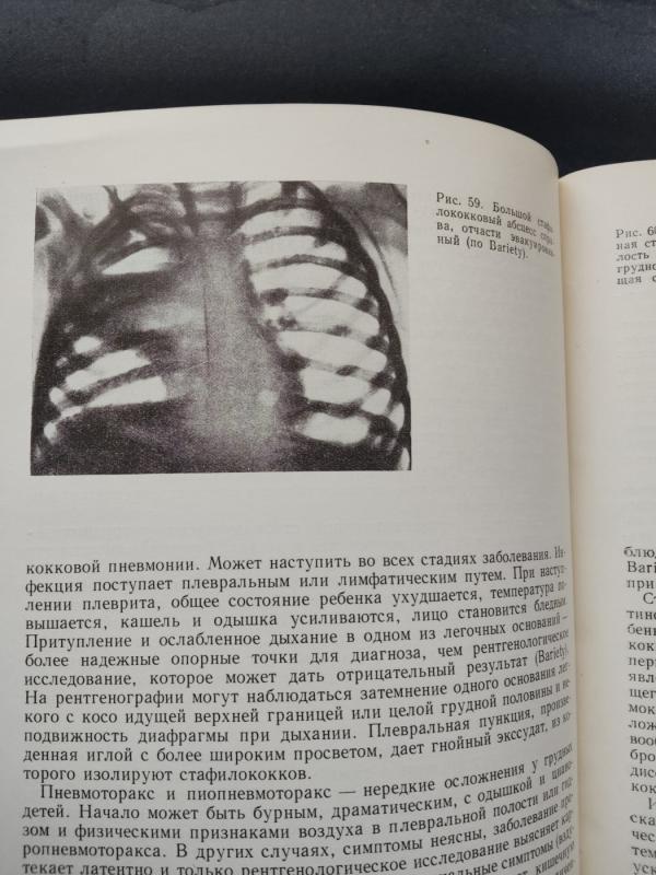 Kvėpavimo ligos - Prof . Ivan Jonikov ir kiti, knyga 5