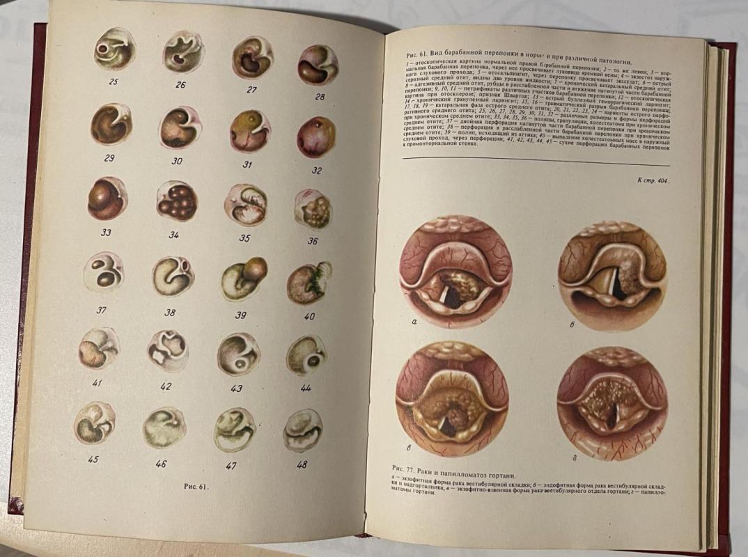 Ausų, nosies ir gerklės ligos - Palčiun, Preobraženskij, knyga 4