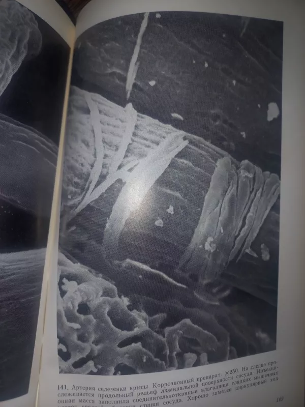 Atlas skanirujušei elektronnoj mikroskopii kletok, tkanei i organov - Volkova i drugije, knyga 6