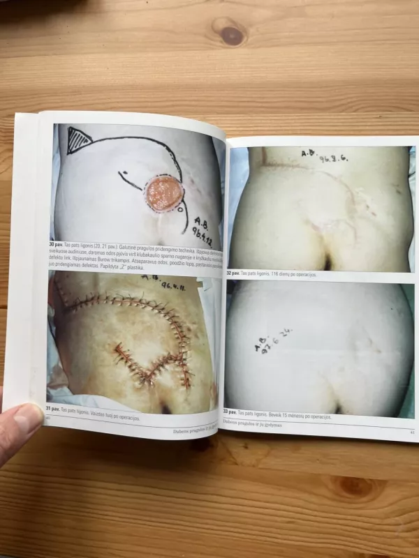 Dubens pragulos ir jų gydymas - Povilas Metrikas, knyga 4