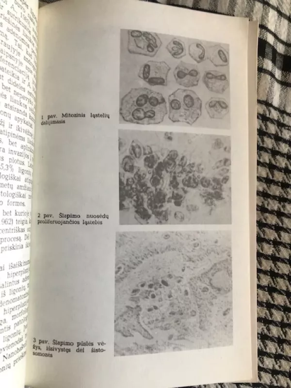 Urologinės sistemos ikivėžines ligos (Gydytojui praktikui) - Vytautas Kamarauskas, knyga 4