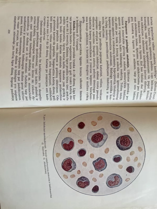 Infekcinės ligos - P. Čibiras, knyga 6