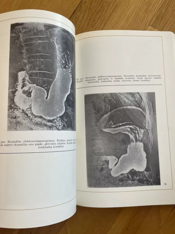 Skrandžio vėžio rentgenodiagnostika - Kazys Ambrozaitis, knyga 6