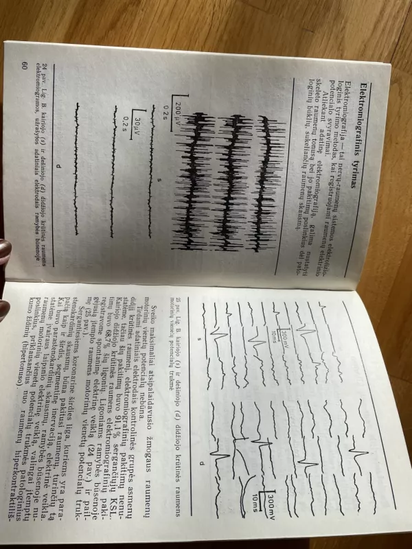 Koronarinė širdies liga - C. Kibarskis, D.  Kaunaitė, knyga 4