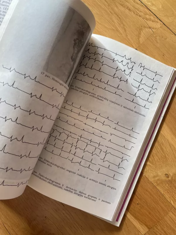 Klinikinė alergologija - Benjaminas Vasiliauskas, knyga 4