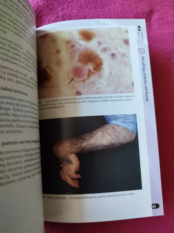 Neurologija: koncentruotas požiūris - Autorių Kolektyvas, knyga 4