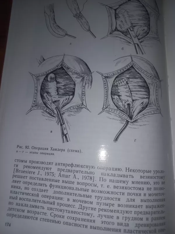 Puzirno močetočnikovij refliuks - Lopatkin, Pugačiov, knyga 6
