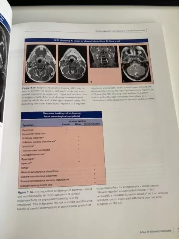 Atlas of Atherothrombosis - Eric Topol et al, knyga 5