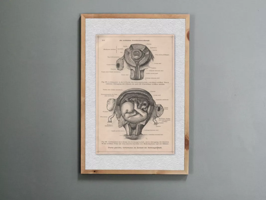 Žmogaus anatomija Moters organai 1908 m. antikvarinis printas litografija iš Anatomischer Atlas albumo - , namai ir interjeras 2