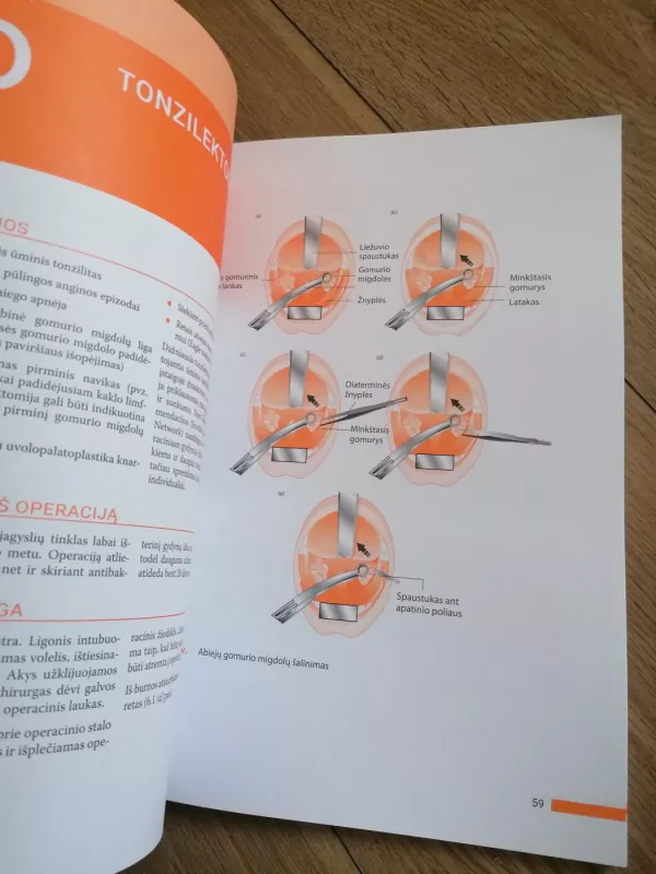 Ausų, nosies ir gerklės ligos - Jame Tysome, knyga 6