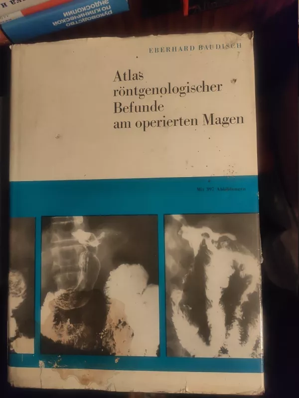 Atlas roentgenologischer Befunde am operierten Magen - Ebehard Baudisch, knyga 2