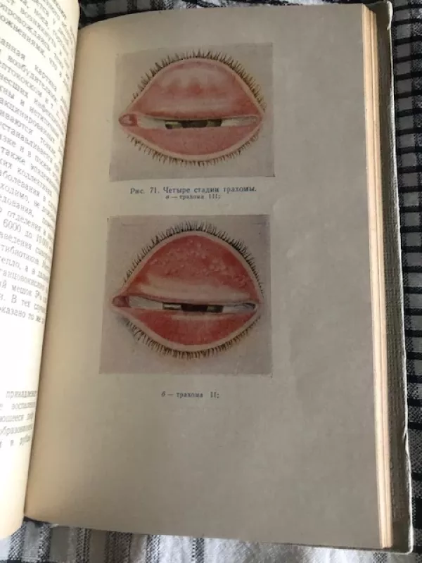 Akių ligos (rusų k) - Zolotoriova M. M., knyga 6