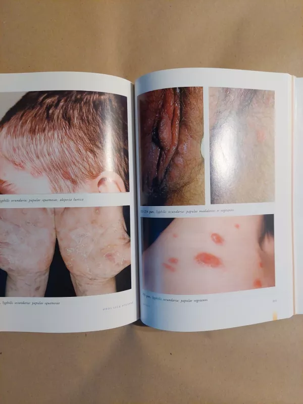 Odos ligų atlasas - Gerimanta Balevičienė, knyga 4