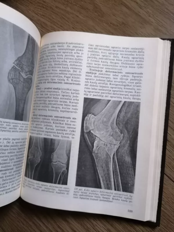 Atramos judamojo aparato ligų rentgenodiagnostika - Kazys Ambrozaitis, knyga 3