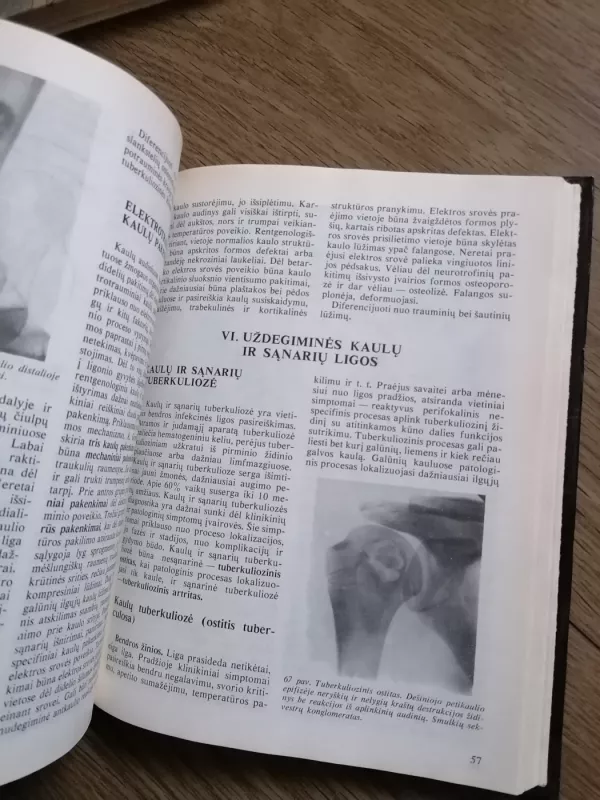 Atramos judamojo aparato ligų rentgenodiagnostika - Kazys Ambrozaitis, knyga 5