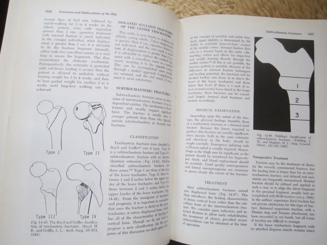 Fractures   Volume 2 - Roccwood and Green, knyga 5