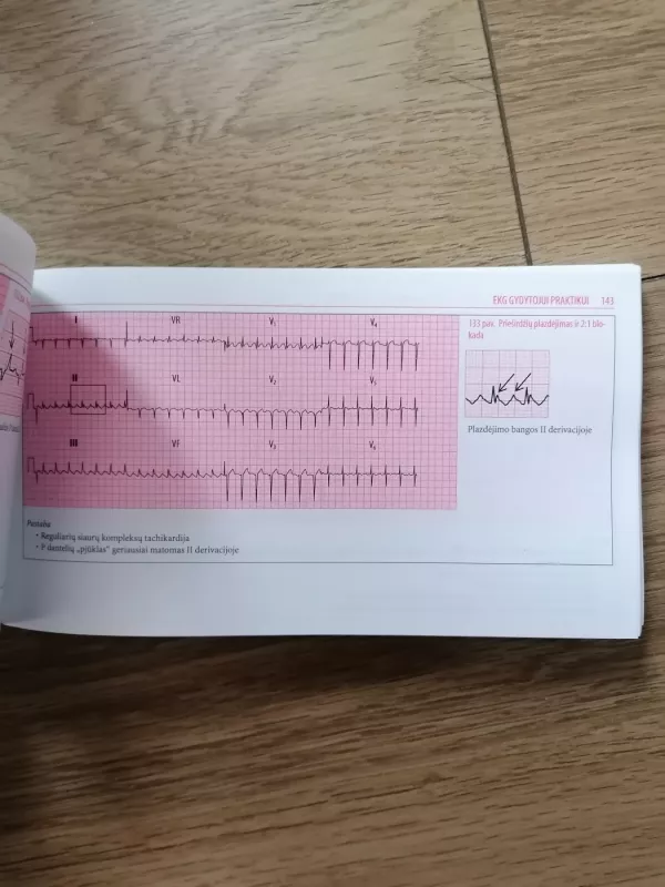 EKG gydytojui praktikui - Johan R.Hampton, knyga 5