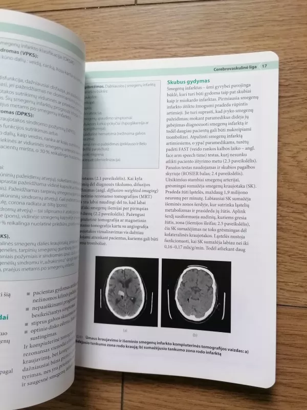 Arterijų ir venų ligos - Tim England, Akhtar Nasim, knyga 5