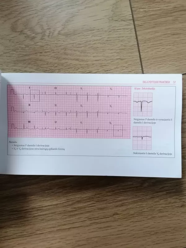 EKG gydytojui praktikui - Johan R.Hampton, knyga 3