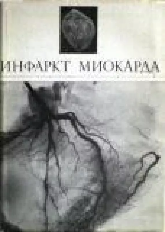 Инфаркт миокарда - A.В. Виноградов, knyga